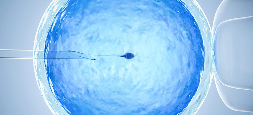 Intra Cytoplasmic Sperm Injection (ICSI)