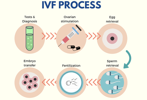 in vitro fertilization Process