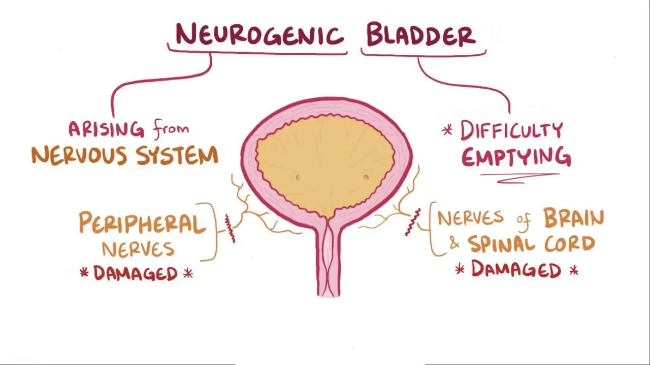 Neurogenic Bladder Treatment in Kurnool